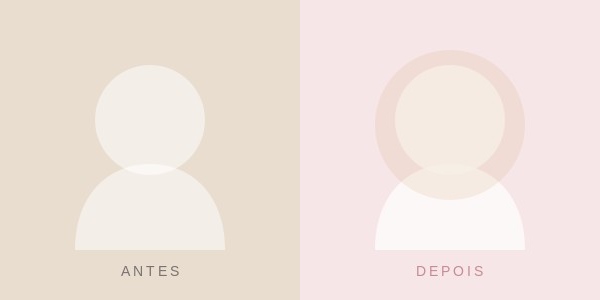 antes-depois-galeria-bioestimulador-antes Página Inicial